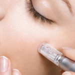 Microneedling MunayQi salon Purmerend